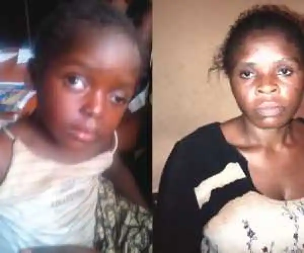 Woman Tortures Her 3-Year-Old Niece To A Coma